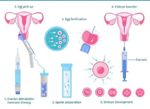 Pros and Cons of IVF