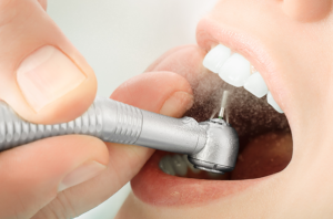 6 Tips To Find The Best Dentist For Your Next Teeth Restoration