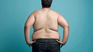 Unraveling the Connection Between Obesity and Back Pain